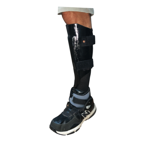 Left leg in shoe wearing prosthetic foot kit with t-strap