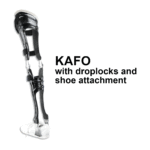 KAFO with droplocks and shoe attachment