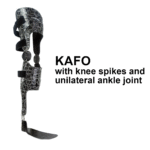 KAFO with knee spikes and unilateral ankle joint