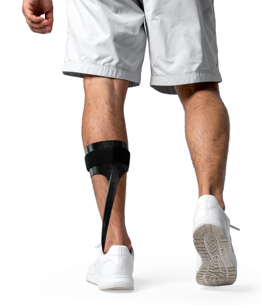 Custom Carbon Fiber AFO & KAFO Braces