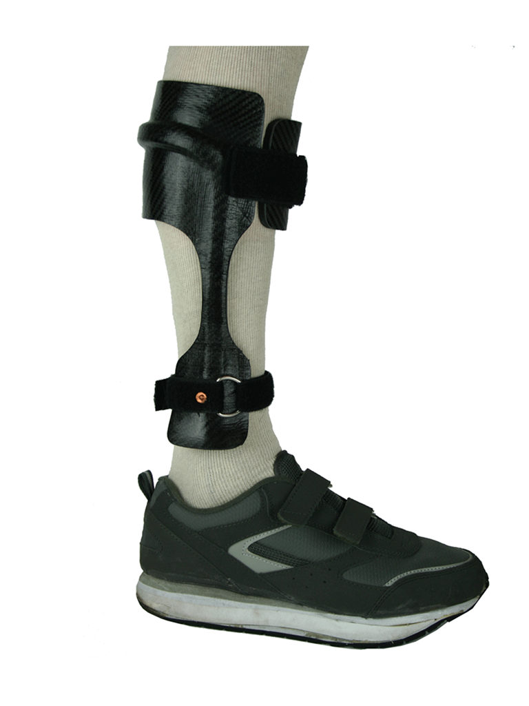 Carbon Fiber AFO Braces & Orthotics by Kinetic Research