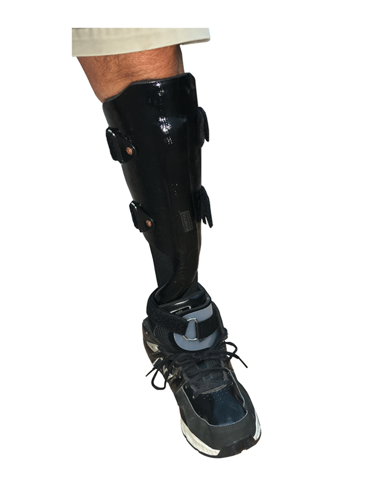 Carbon Fiber AFO Braces & Orthotics by Kinetic Research